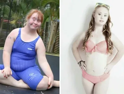 Cette jeune fille de 18 ans est atteinte de trisomie 21 et rêve de devenir… mannequin