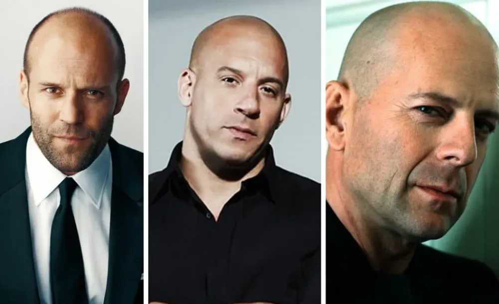 Les hommes chauves sont plus attirants et plus masculins, selon une étude scientifique.