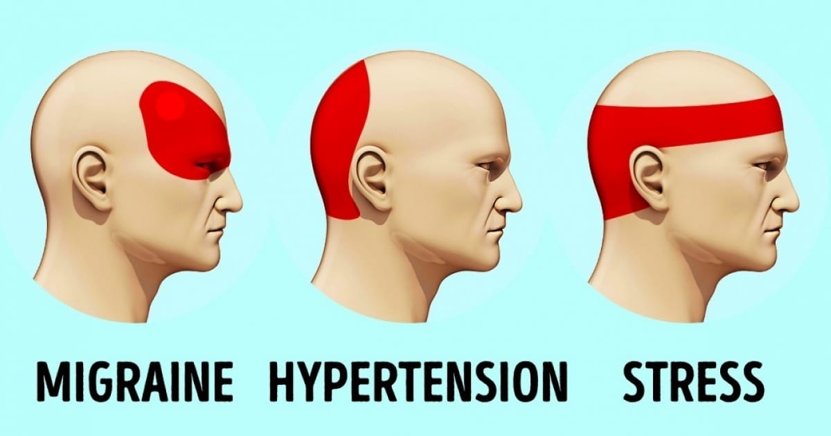 Comment se débarrasser d'un mal de tête en 5 minutes sans 